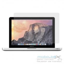   XPRO™ Ultra Clear kijelzővédő fólia Macbook Pro 16″ készülékhez